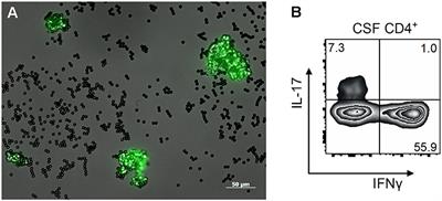 Primary Angiitis of the Central Nervous System: New Potential Imaging Techniques and Biomarkers in Blood and Cerebrospinal Fluid